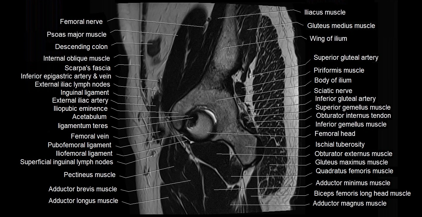 male pelvis sagittal cross sectional anatomy 3T mri image 4.webp